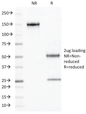 Data from SDS-PAGE analysis of Anti-Olig2 antibody (Clone OLIG2/2400). Reducing lane (R) shows heavy and light chain fragments. NR lane shows intact antibody with expected MW of approximately 150 kDa. The data are consistent with a high purity, intact mAb.